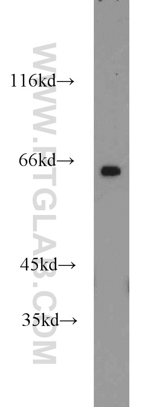 Western Blot (WB) analysis of mouse brain tissue using CAMKV Polyclonal antibody (14788-1-AP)