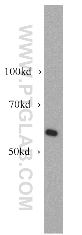 Western Blot (WB) analysis of HeLa cells using CAMKV Polyclonal antibody (14788-1-AP)