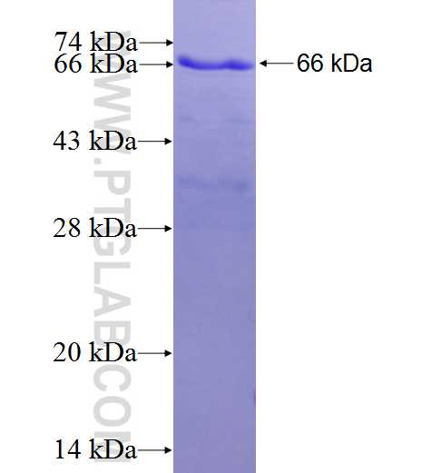 CAMKV fusion protein Ag6438 SDS-PAGE