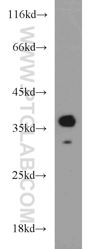 WB analysis of mouse brain using 23327-1-AP