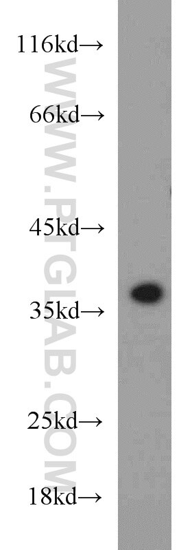 Western Blot (WB) analysis of Jurkat cells using CAMLG Polyclonal antibody (23327-1-AP)