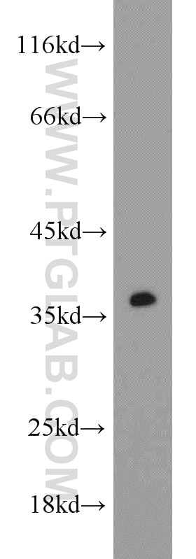 Western Blot (WB) analysis of rat brain tissue using CAMLG Polyclonal antibody (23327-1-AP)