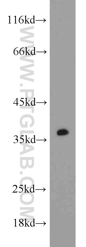 WB analysis of rat brain using 23327-1-AP