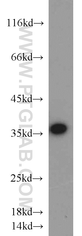 Western Blot (WB) analysis of human testis tissue using CAMLG Polyclonal antibody (23327-1-AP)