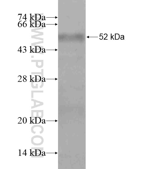 CAMLG fusion protein Ag19223 SDS-PAGE