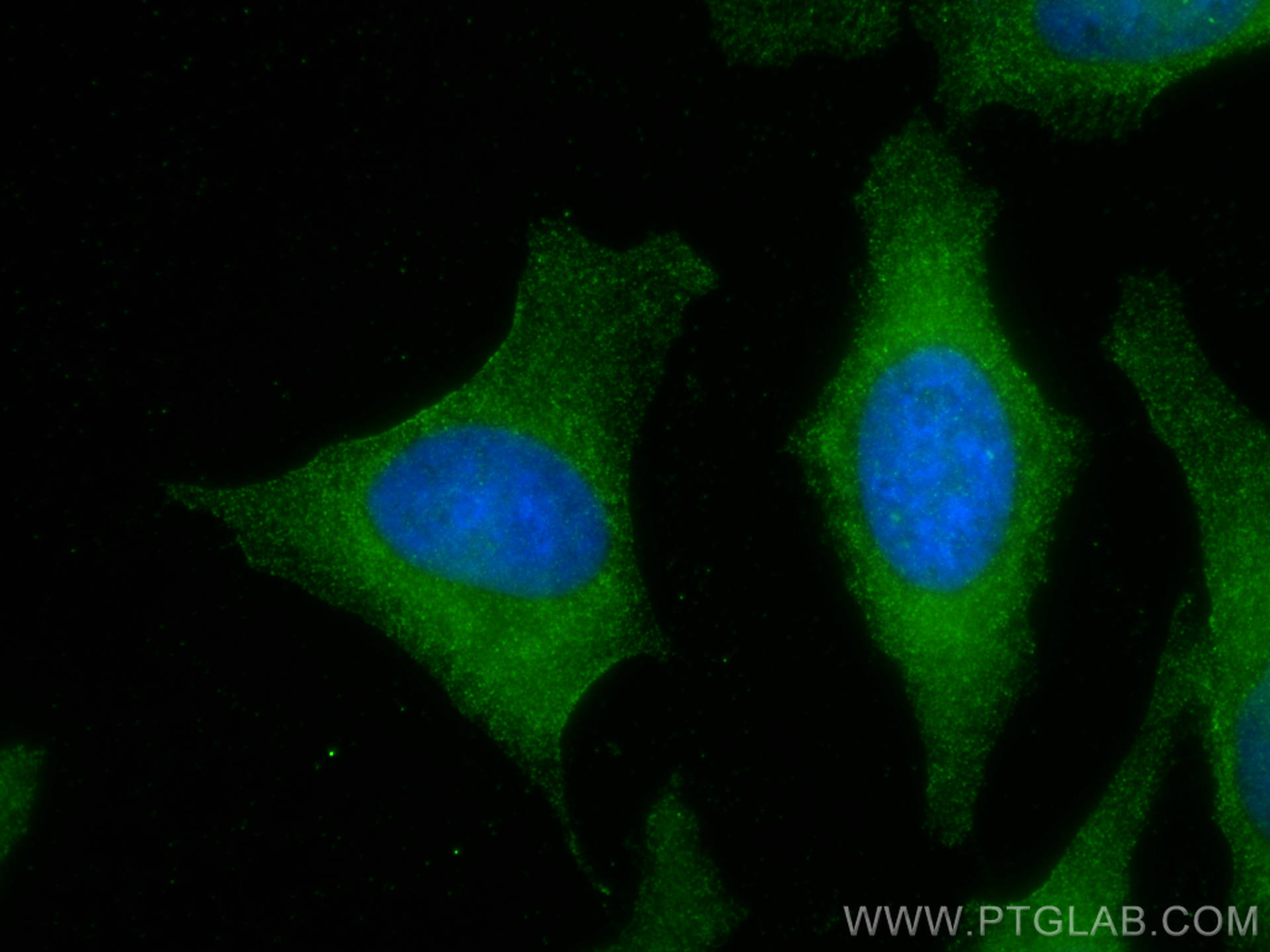 Immunofluorescence (IF) / fluorescent staining of HeLa cells using CAMP Polyclonal antibody (12009-1-AP)