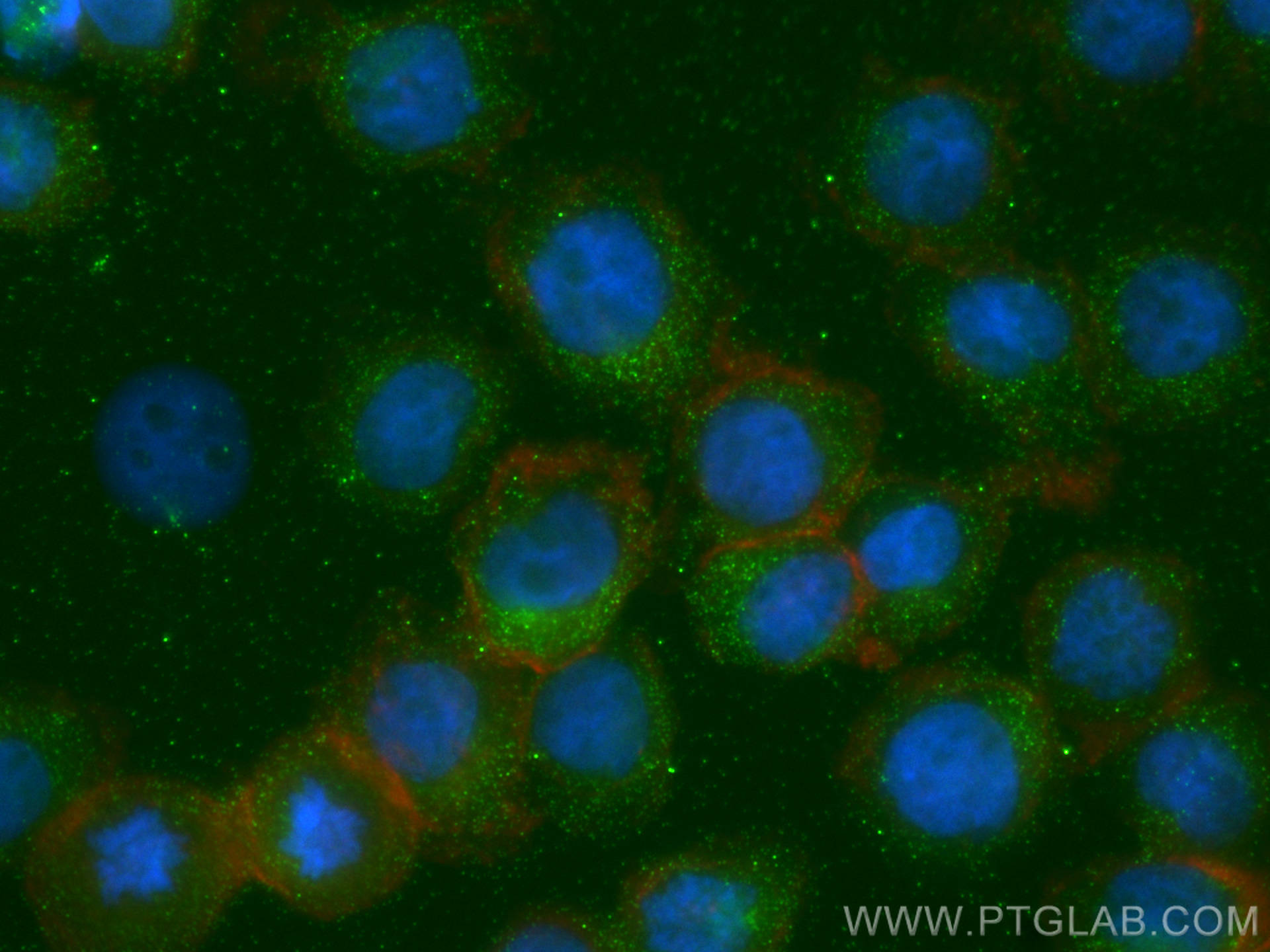 Immunofluorescence (IF) / fluorescent staining of THP-1 cells using CAMP Polyclonal antibody (12009-1-AP)