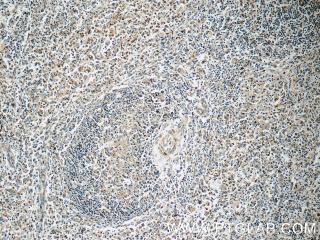 Immunohistochemistry (IHC) staining of human spleen tissue using CAMP Polyclonal antibody (12009-1-AP)