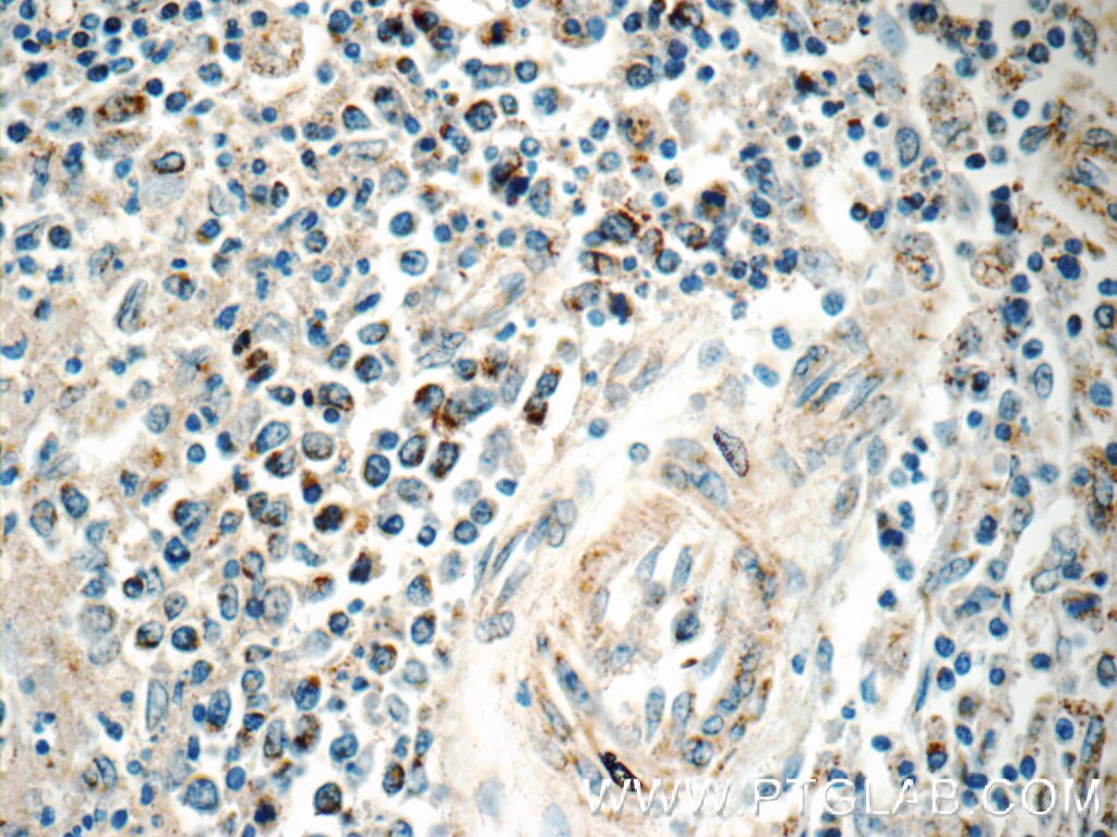 Immunohistochemistry (IHC) staining of human spleen tissue using CAMP Polyclonal antibody (12009-1-AP)