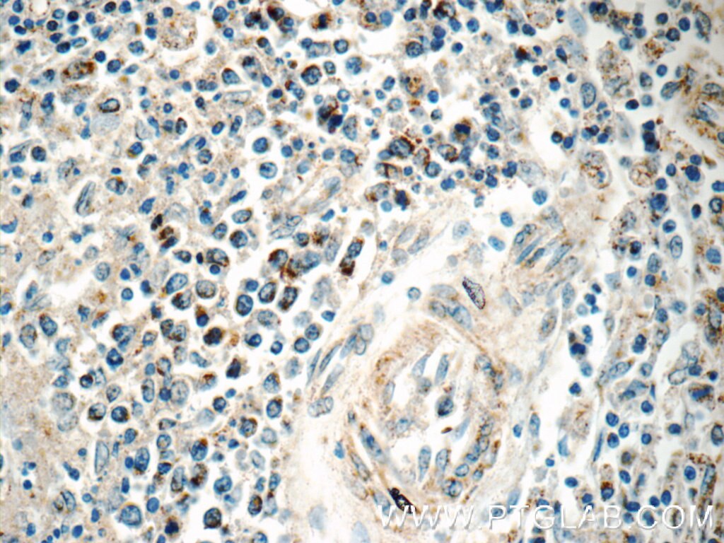 IHC staining of human spleen using 12009-1-AP