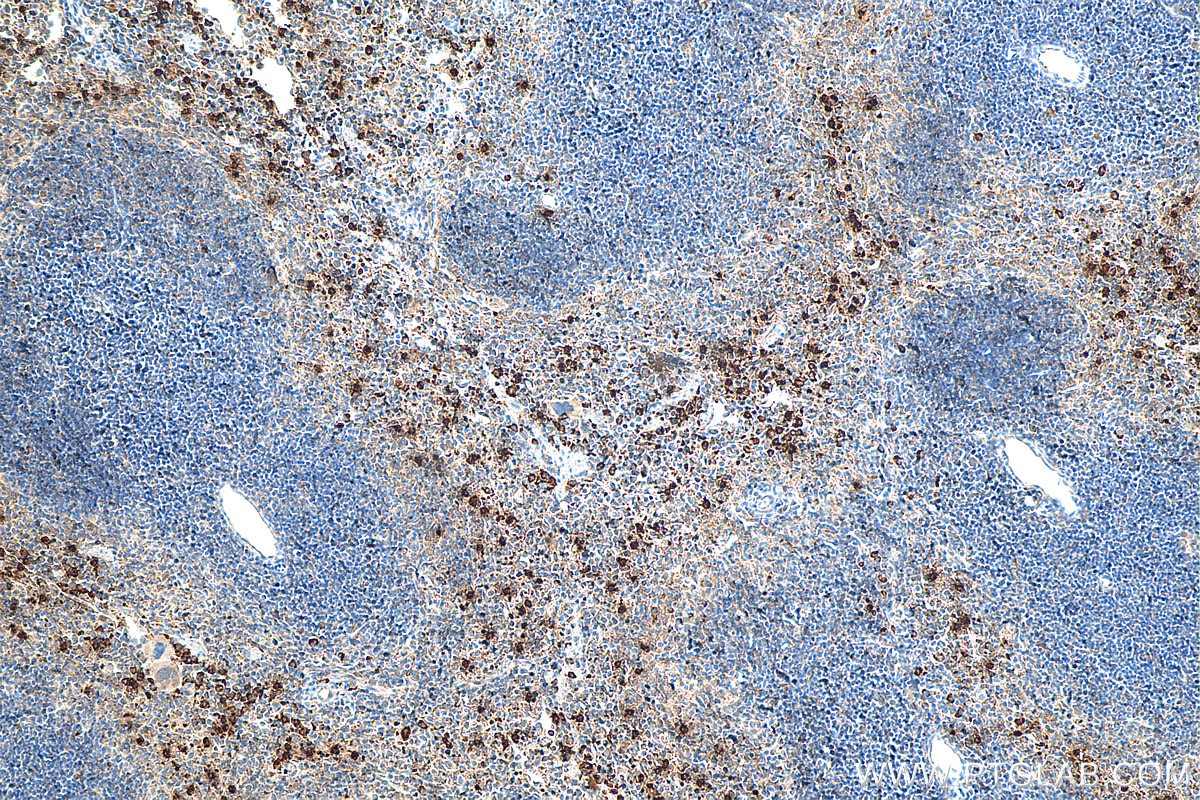 Immunohistochemistry (IHC) staining of mouse spleen tissue using CAMP Polyclonal antibody (12009-1-AP)