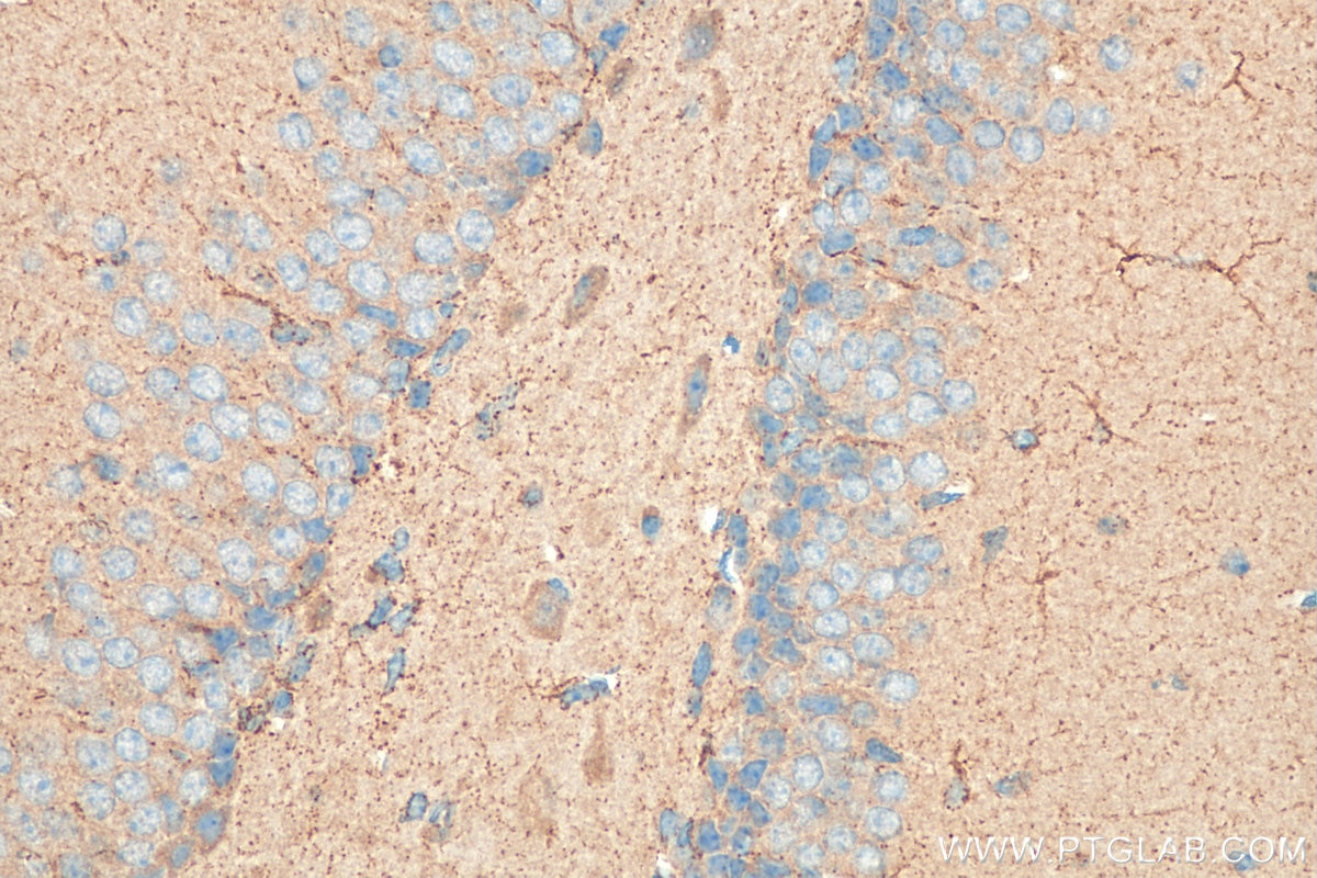 Immunohistochemistry (IHC) staining of mouse brain tissue using CAMP Polyclonal antibody (12009-1-AP)