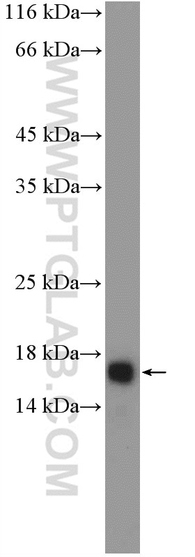 CAMP Polyclonal antibody