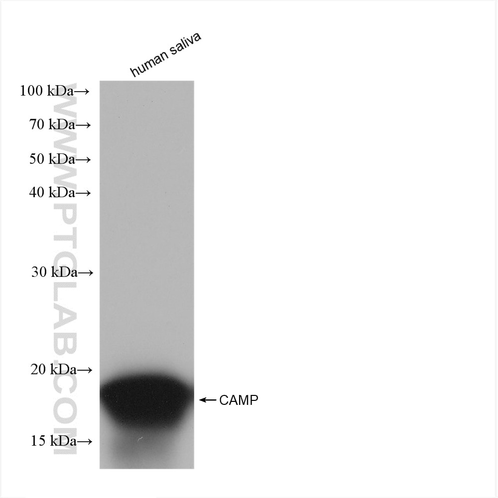 Western Blot (WB) analysis of human saliva using CAMP Recombinant antibody (82940-1-RR)