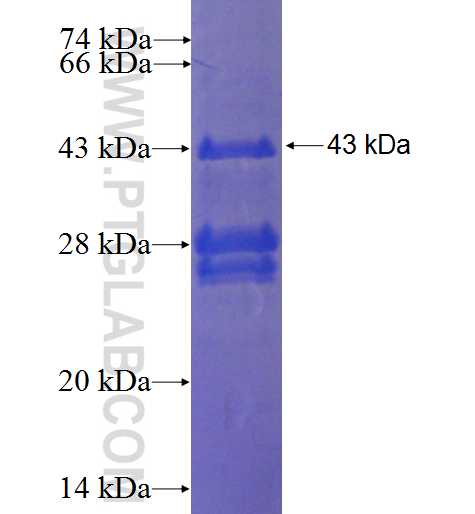 CAMP fusion protein Ag2622 SDS-PAGE