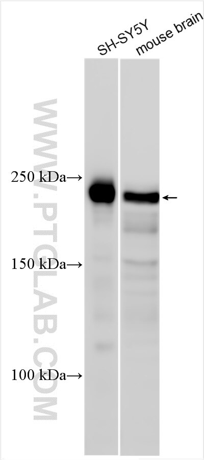Western Blot (WB) analysis of various lysates using CAMSAP1 Polyclonal antibody (18816-1-AP)