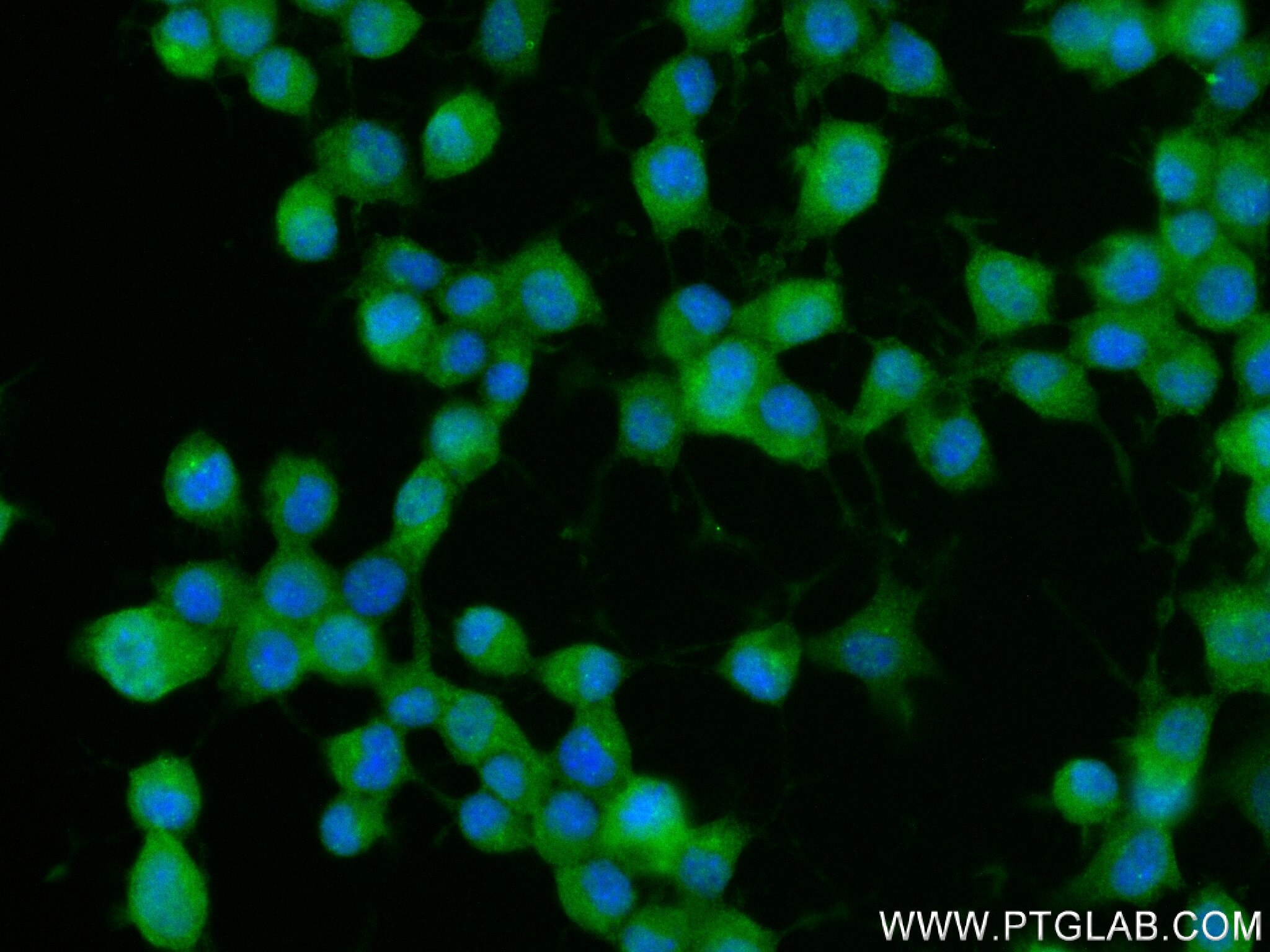 Immunofluorescence (IF) / fluorescent staining of Neuro-2a cells using CAMSAP1 Recombinant antibody (83864-1-RR)