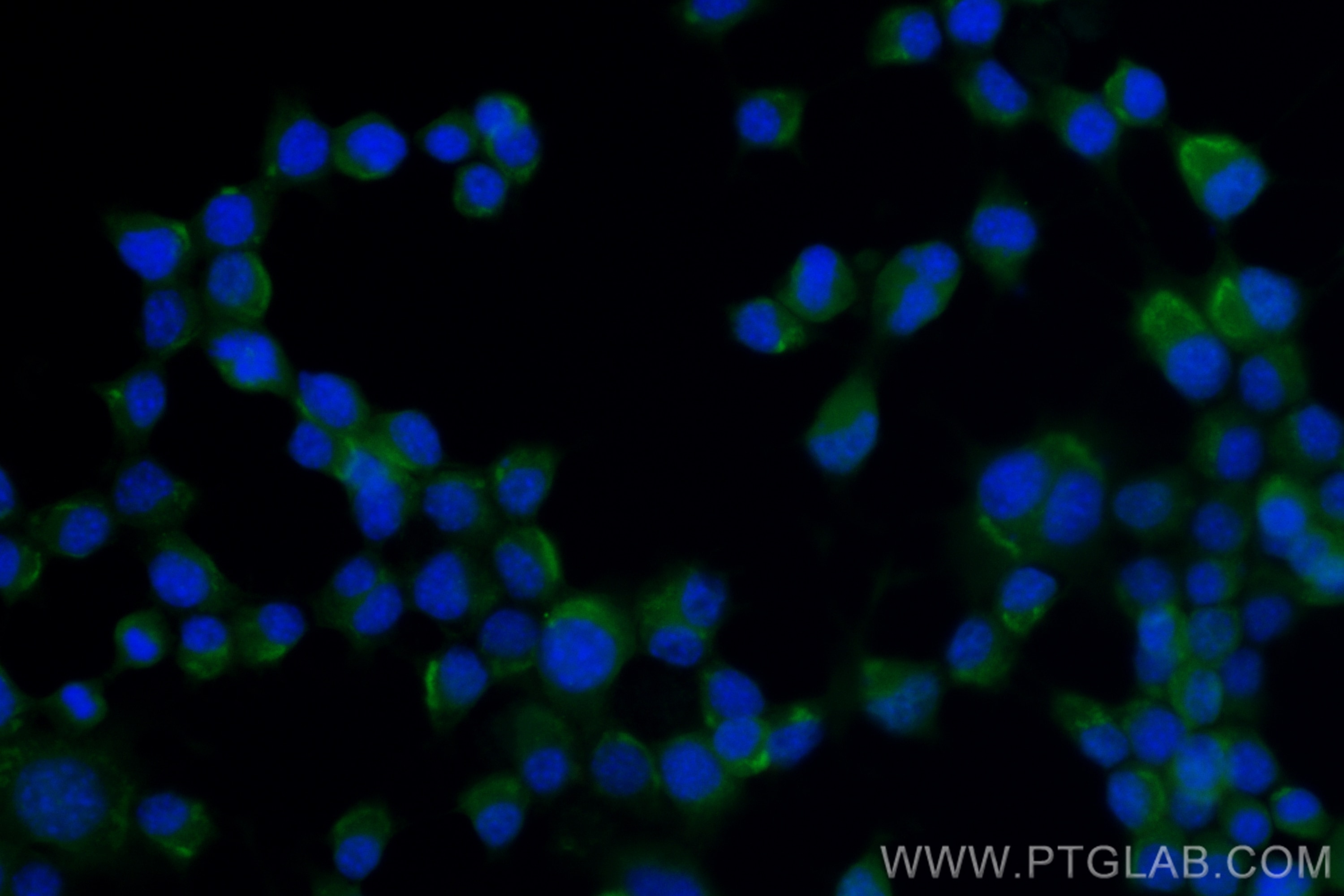 Immunofluorescence (IF) / fluorescent staining of Neuro-2a cells using CoraLite® Plus 488-conjugated CAMSAP1 Recombinant  (CL488-83864)
