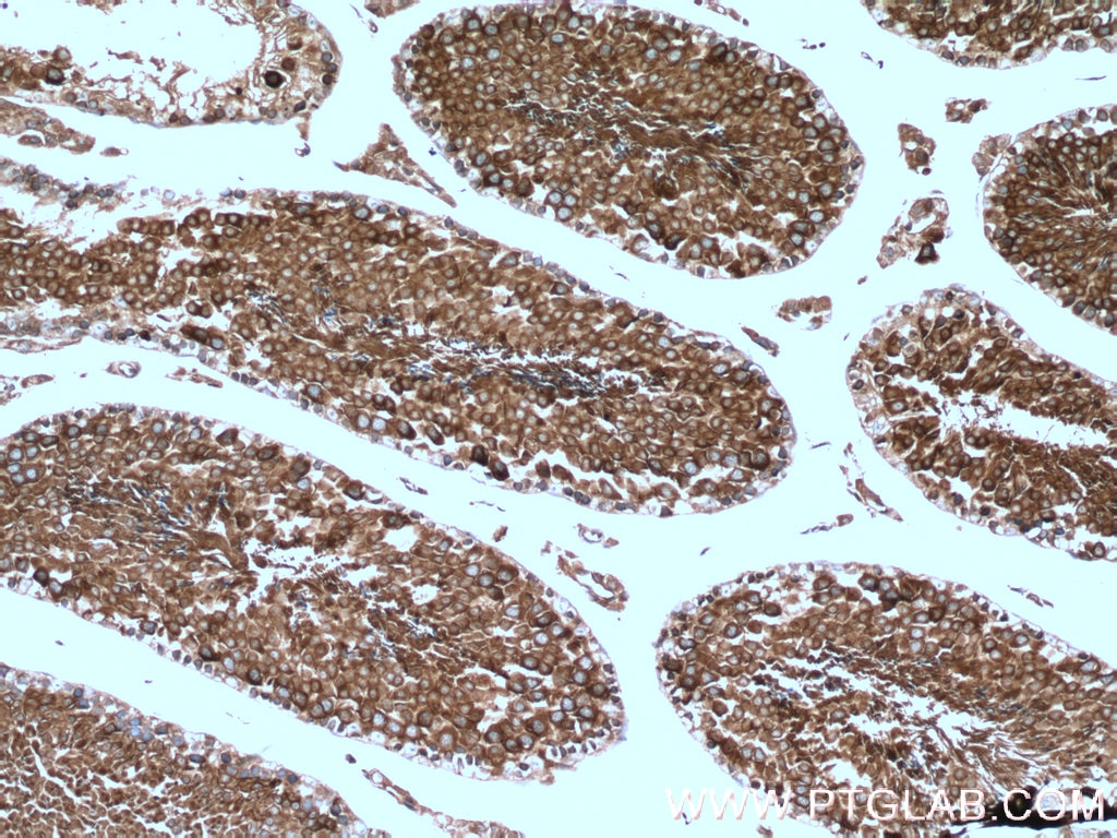 Immunohistochemistry (IHC) staining of mouse testis tissue using CAMSAP2 Polyclonal antibody (17880-1-AP)