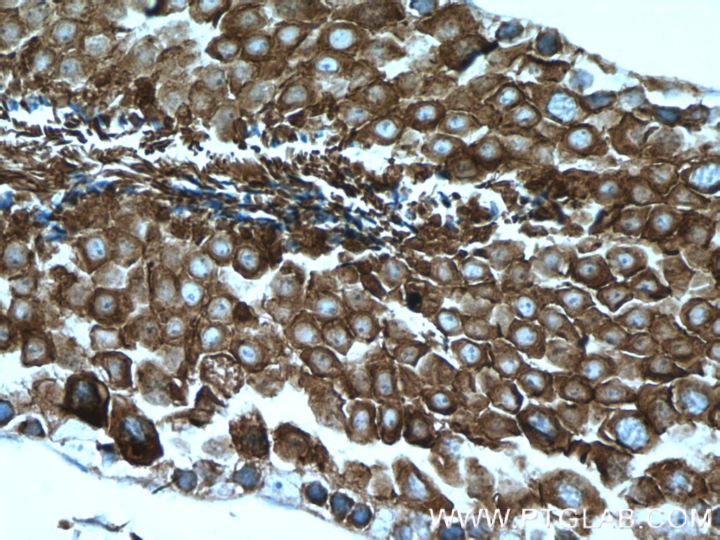 Immunohistochemistry (IHC) staining of mouse testis tissue using CAMSAP2 Polyclonal antibody (17880-1-AP)