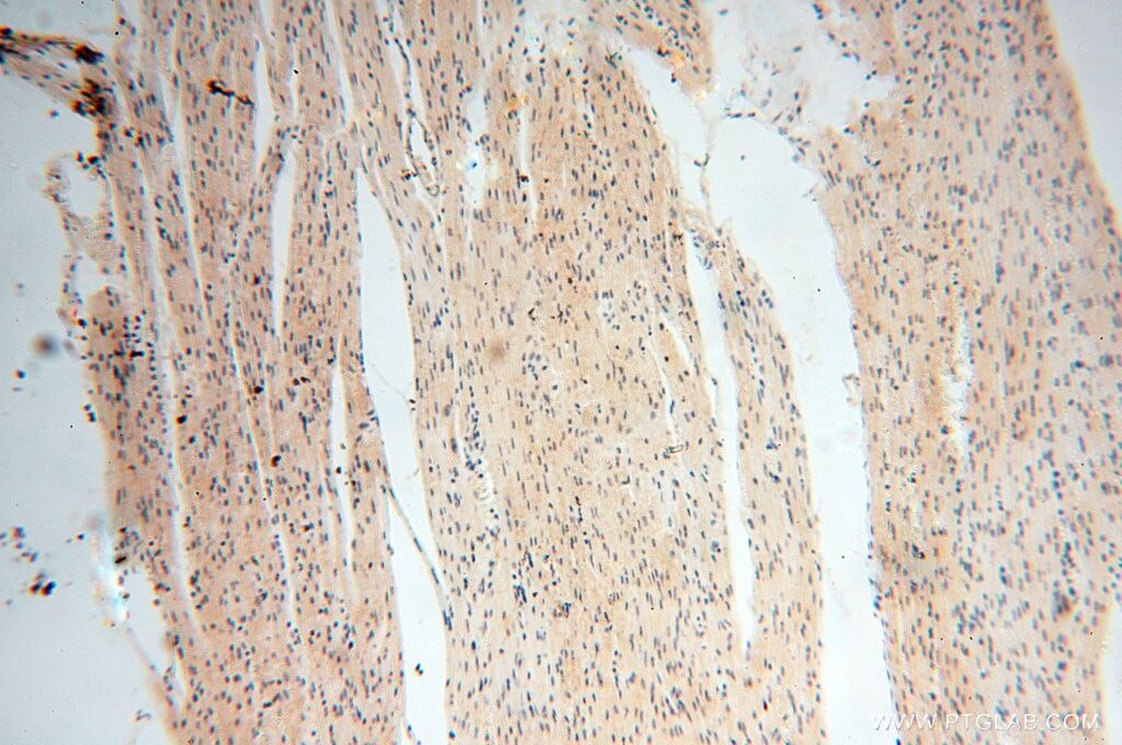 IHC staining of human heart using 17880-1-AP