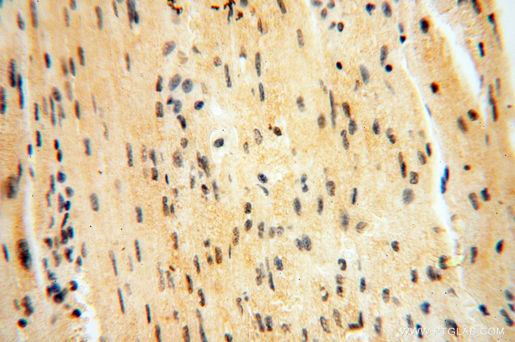 Immunohistochemistry (IHC) staining of human heart tissue using CAMSAP2 Polyclonal antibody (17880-1-AP)