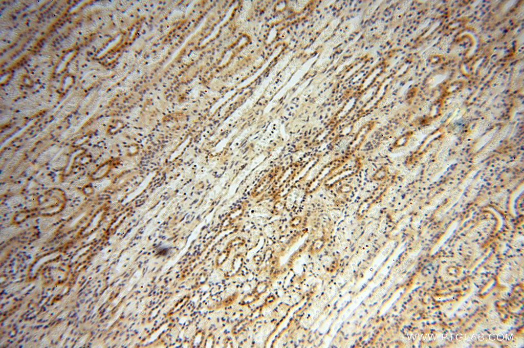 Immunohistochemistry (IHC) staining of human kidney tissue using CAMSAP2 Polyclonal antibody (17880-1-AP)