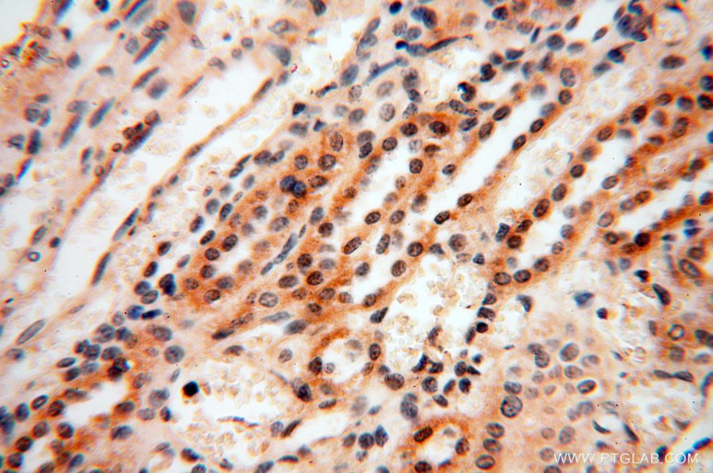 Immunohistochemistry (IHC) staining of human kidney tissue using CAMSAP2 Polyclonal antibody (17880-1-AP)