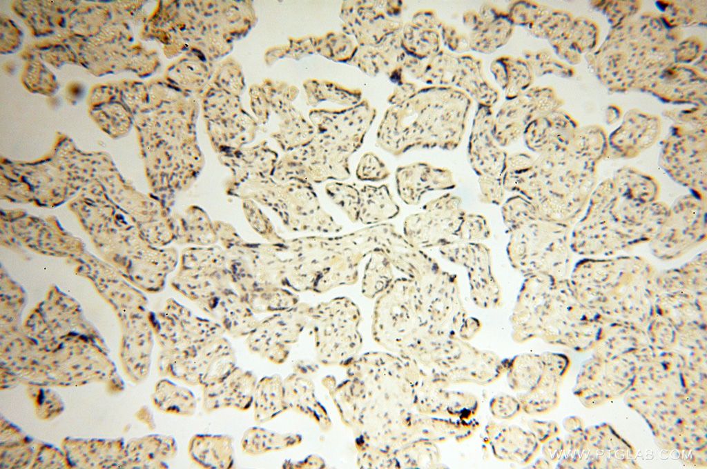 Immunohistochemistry (IHC) staining of human placenta tissue using CAMSAP2 Polyclonal antibody (17880-1-AP)