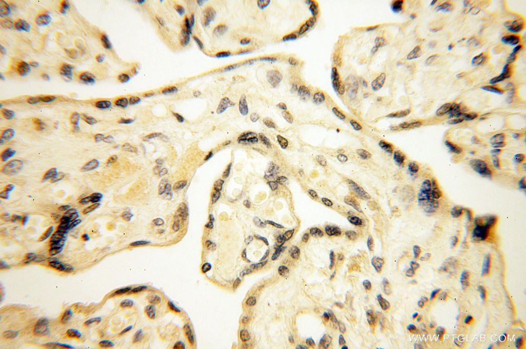 Immunohistochemistry (IHC) staining of human placenta tissue using CAMSAP2 Polyclonal antibody (17880-1-AP)