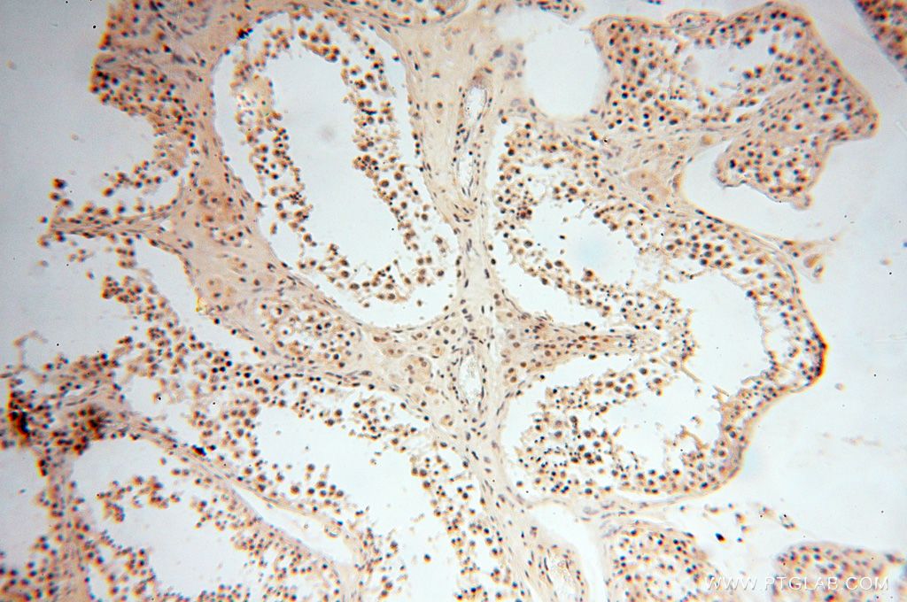 Immunohistochemistry (IHC) staining of human testis tissue using CAMSAP2 Polyclonal antibody (17880-1-AP)