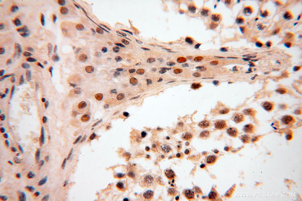 Immunohistochemistry (IHC) staining of human testis tissue using CAMSAP2 Polyclonal antibody (17880-1-AP)