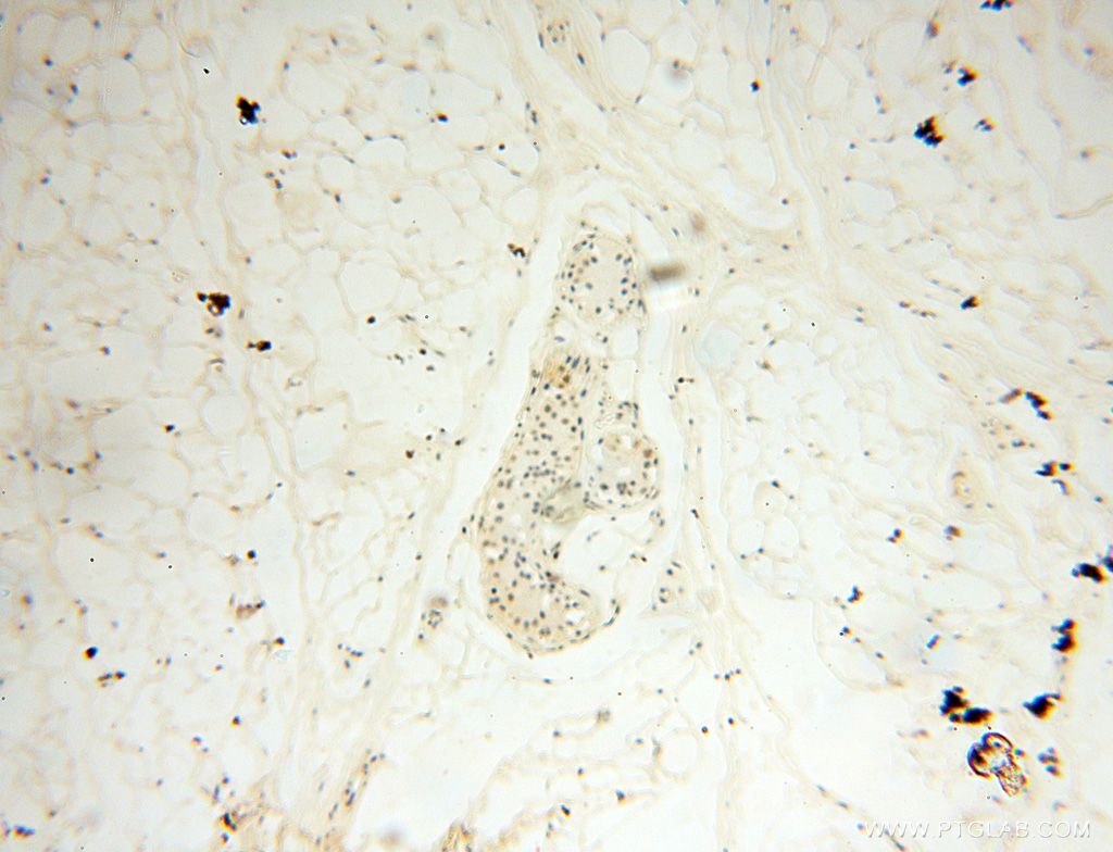 IHC staining of human skin using 17880-1-AP