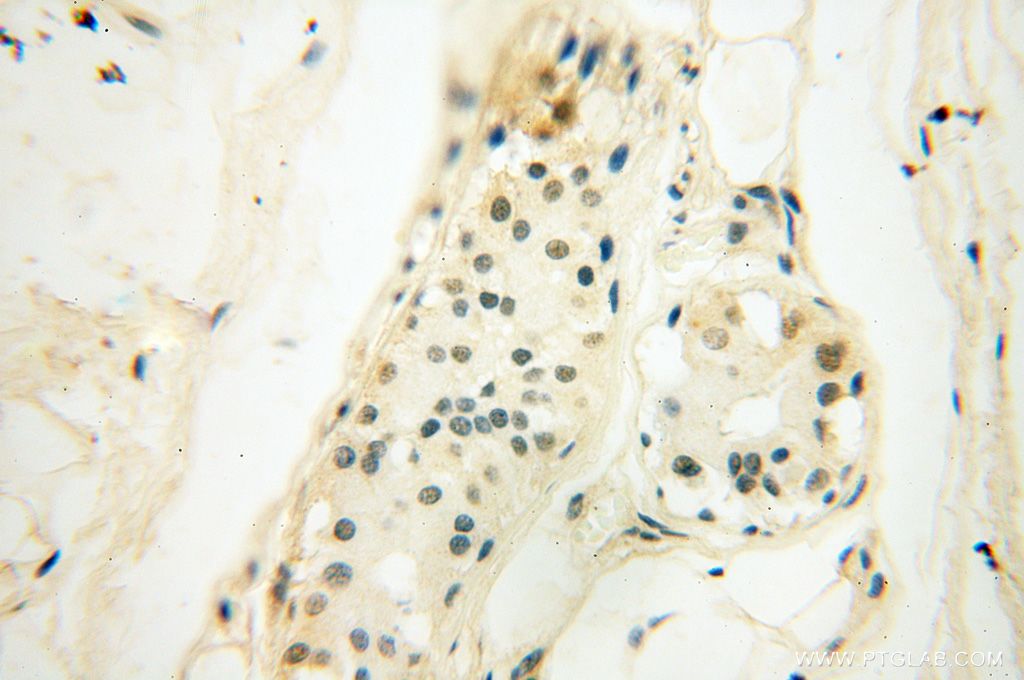 Immunohistochemistry (IHC) staining of human skin tissue using CAMSAP2 Polyclonal antibody (17880-1-AP)