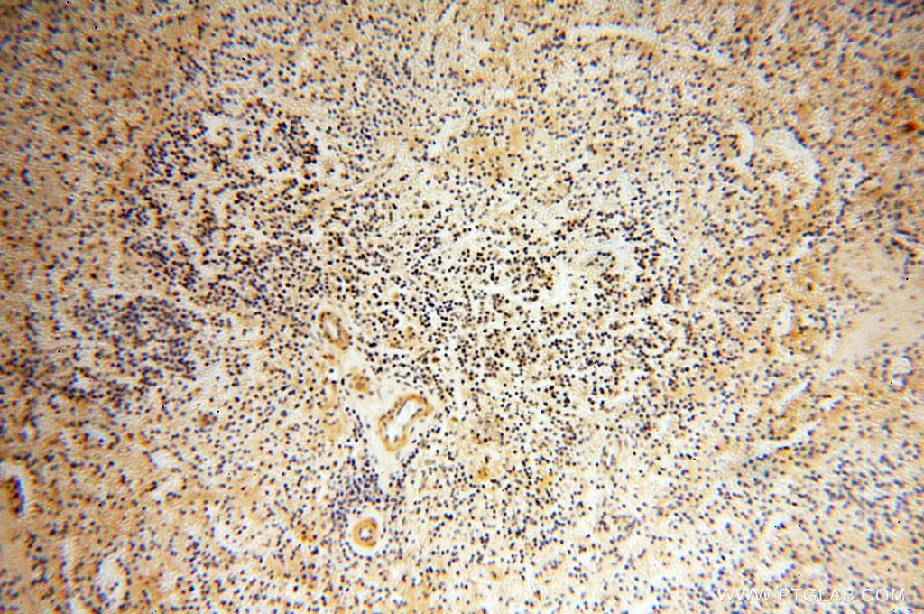 Immunohistochemistry (IHC) staining of human spleen tissue using CAMSAP2 Polyclonal antibody (17880-1-AP)