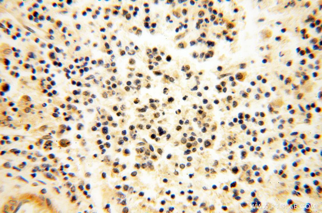 Immunohistochemistry (IHC) staining of human spleen tissue using CAMSAP2 Polyclonal antibody (17880-1-AP)