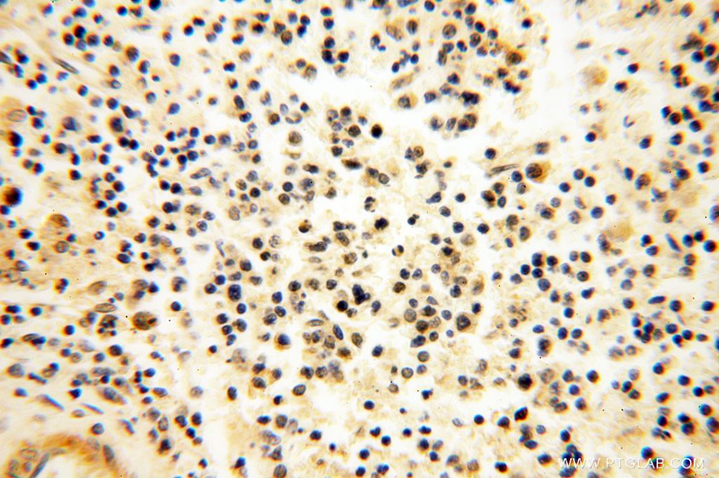 IHC staining of human spleen using 17880-1-AP