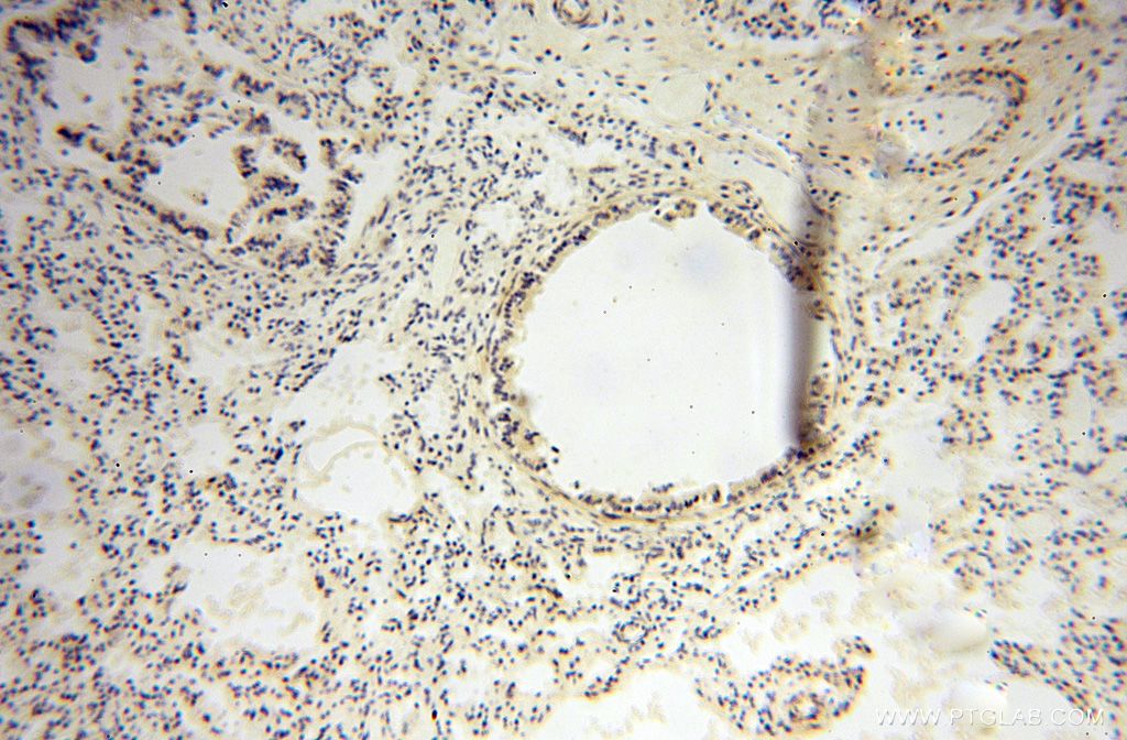 IHC staining of human lung using 17880-1-AP