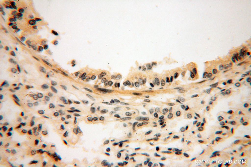 Immunohistochemistry (IHC) staining of human lung tissue using CAMSAP2 Polyclonal antibody (17880-1-AP)