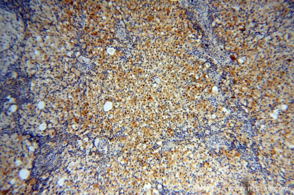 IHC staining of human ovary using 17880-1-AP