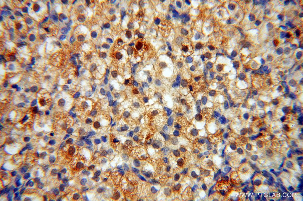Immunohistochemistry (IHC) staining of human ovary tissue using CAMSAP2 Polyclonal antibody (17880-1-AP)