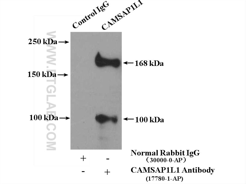 Immunoprecipitation (IP) experiment of PC-3 cells using CAMSAP2 Polyclonal antibody (17880-1-AP)