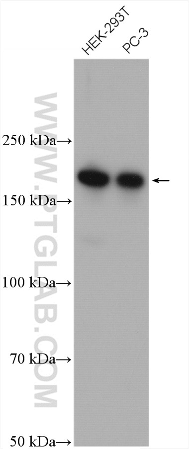 Western Blot (WB) analysis of various lysates using CAMSAP2 Polyclonal antibody (17880-1-AP)