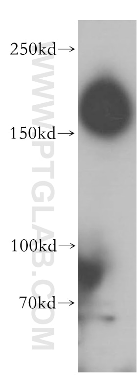 Western Blot (WB) analysis of mouse brain tissue using CAMSAP2 Polyclonal antibody (17880-1-AP)