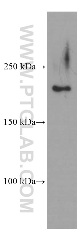 Western Blot (WB) analysis of HeLa cells using CAMSAP2 Monoclonal antibody (66463-1-Ig)