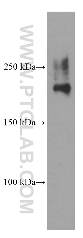 Western Blot (WB) analysis of PC-3 cells using CAMSAP2 Monoclonal antibody (66463-1-Ig)