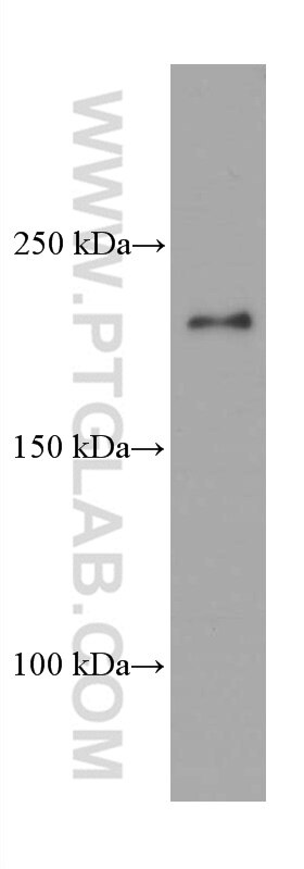 Western Blot (WB) analysis of rat brain tissue using CAMSAP2 Monoclonal antibody (66463-1-Ig)