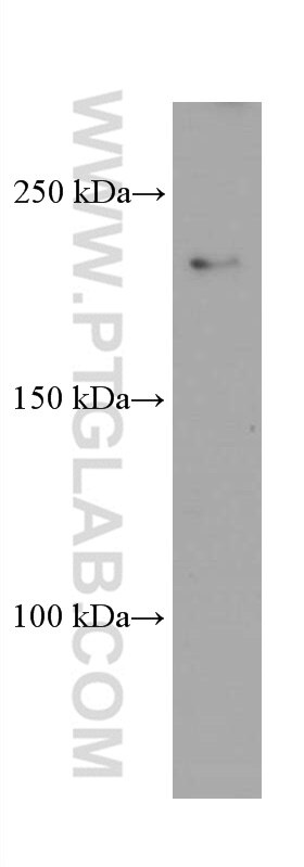 Western Blot (WB) analysis of mouse brain tissue using CAMSAP2 Monoclonal antibody (66463-1-Ig)