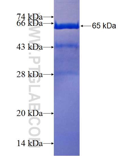 CAMSAP1L1 fusion protein Ag11794 SDS-PAGE