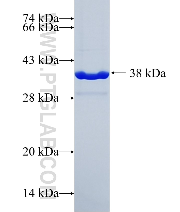 CAMSAP3 fusion protein Ag34631 SDS-PAGE CAMSAP3 fusion protein Ag34631 SDS-PAGE